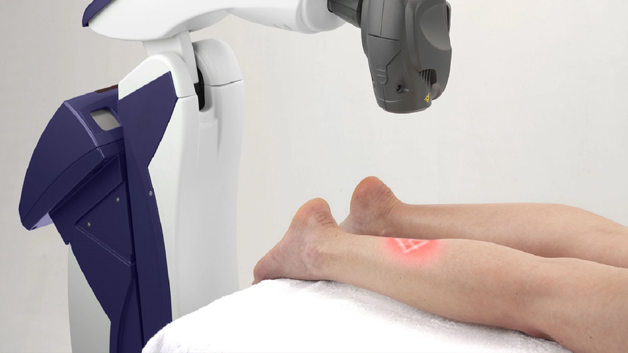 Integrating Laser Therapy into Healthcare Systems